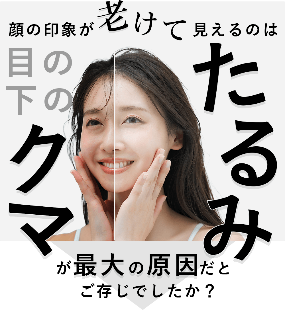 顔の印象が老けて見えるのは目の下のクマ・たるみが最大の原因だとご存じでしたか？