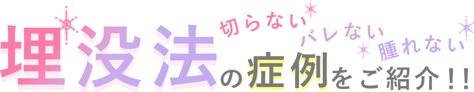 切らないバレない腫れない埋没法の症例をご紹介！