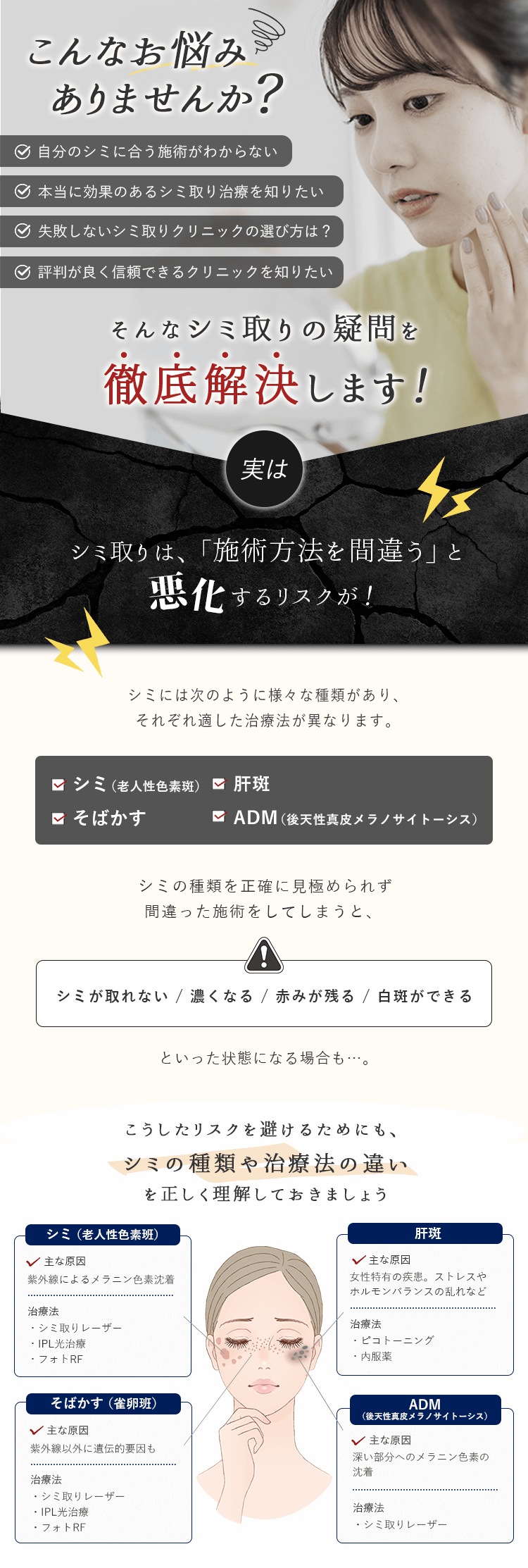 シミ取りの疑問徹底解決