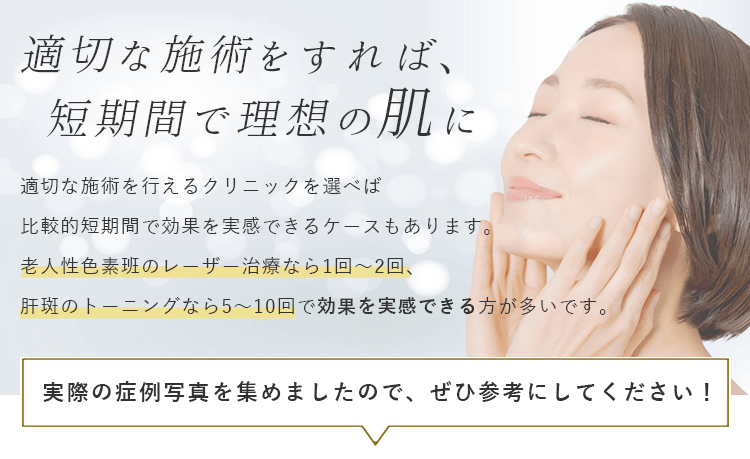 適切な施術をすれば、短期間で理想の肌に