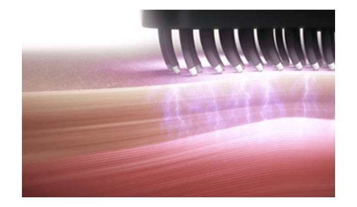 独自のEMS電流で筋肉に直接アプローチ！