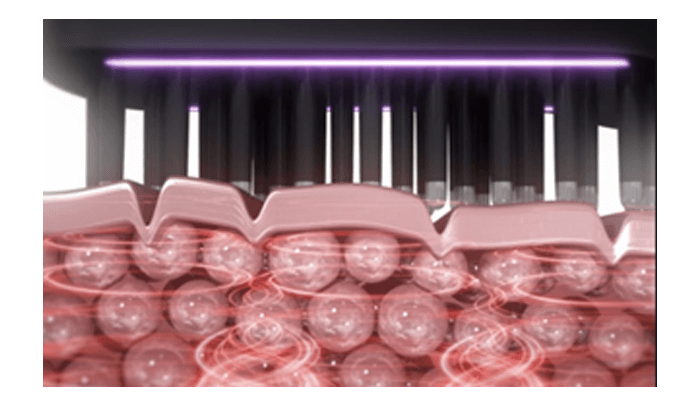 自動調整RFを搭載！肌のもたつきをケア