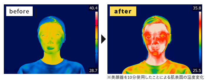 ビフォーアフター