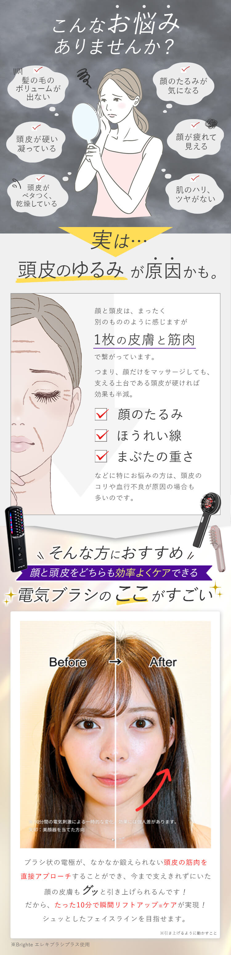 お悩みの原因は頭皮のたるみです!