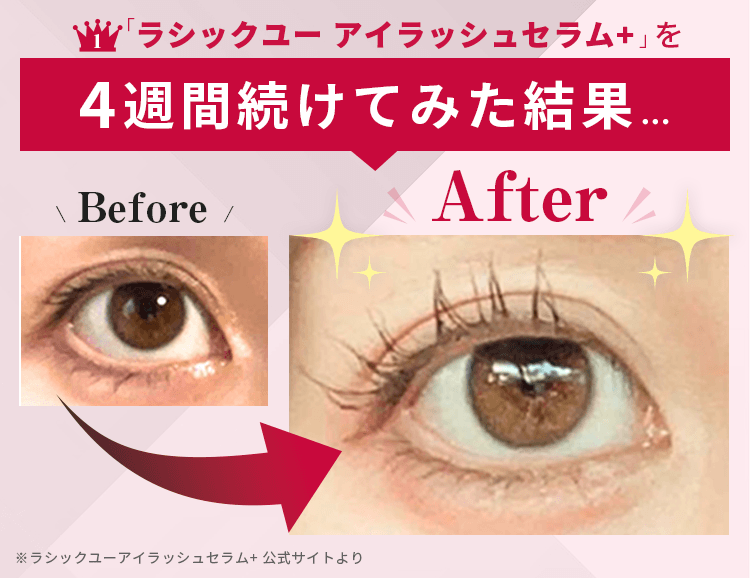 4週間で大きく変化が見られます