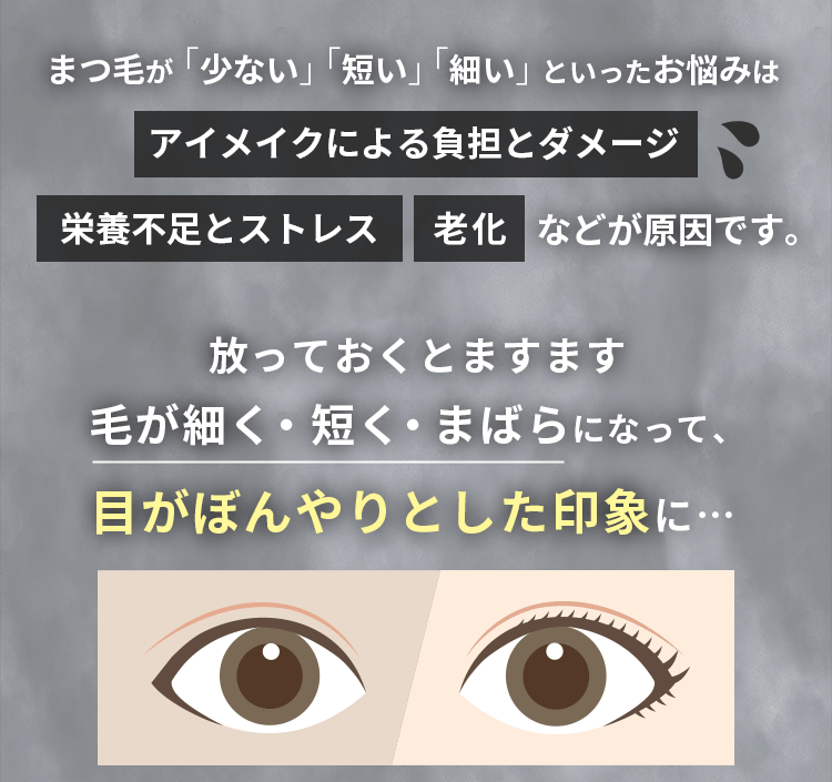 アイメイクによる負担とダメージ、栄養不足とストレス、老化などが原因