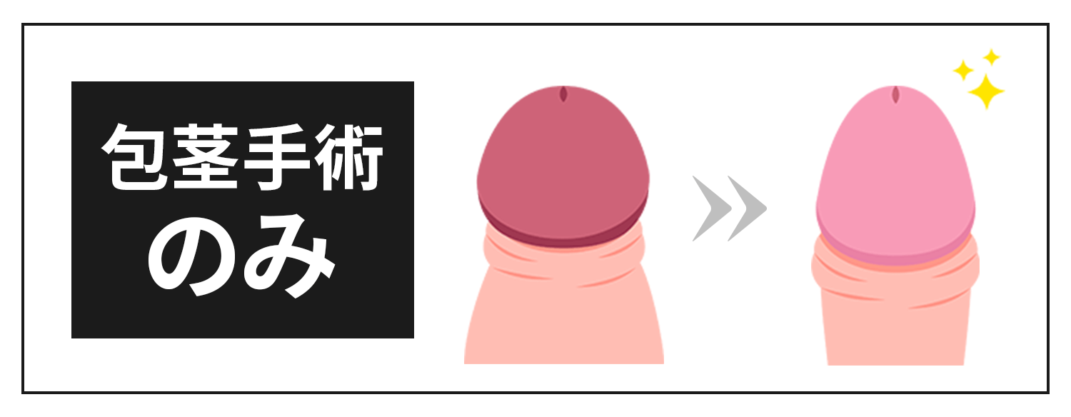 包茎手術のみ
