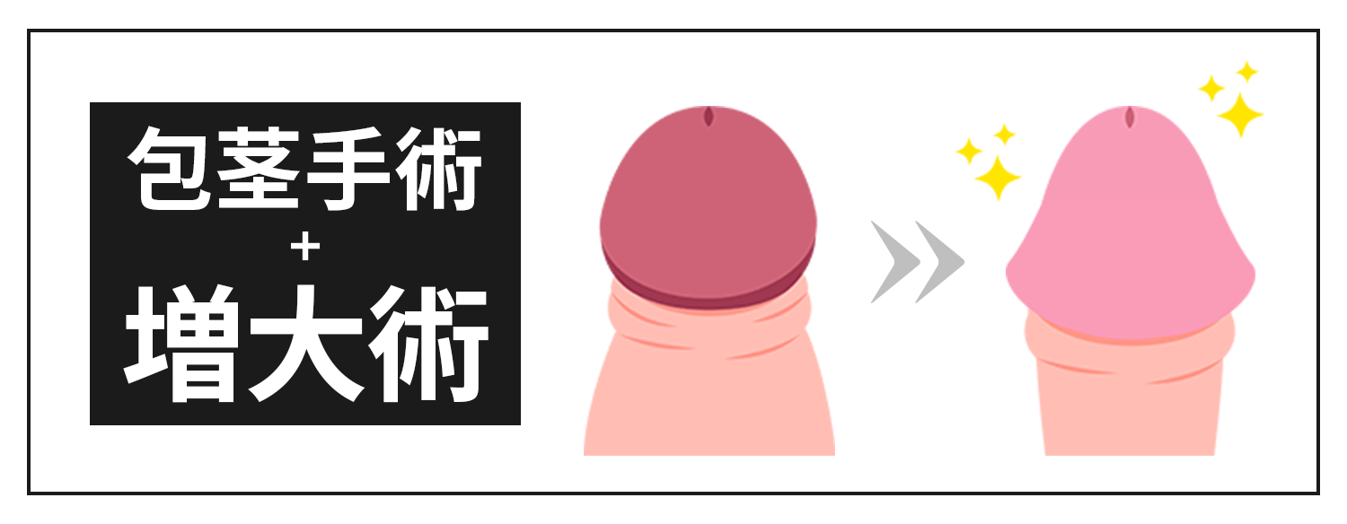 包茎手術+増大手術