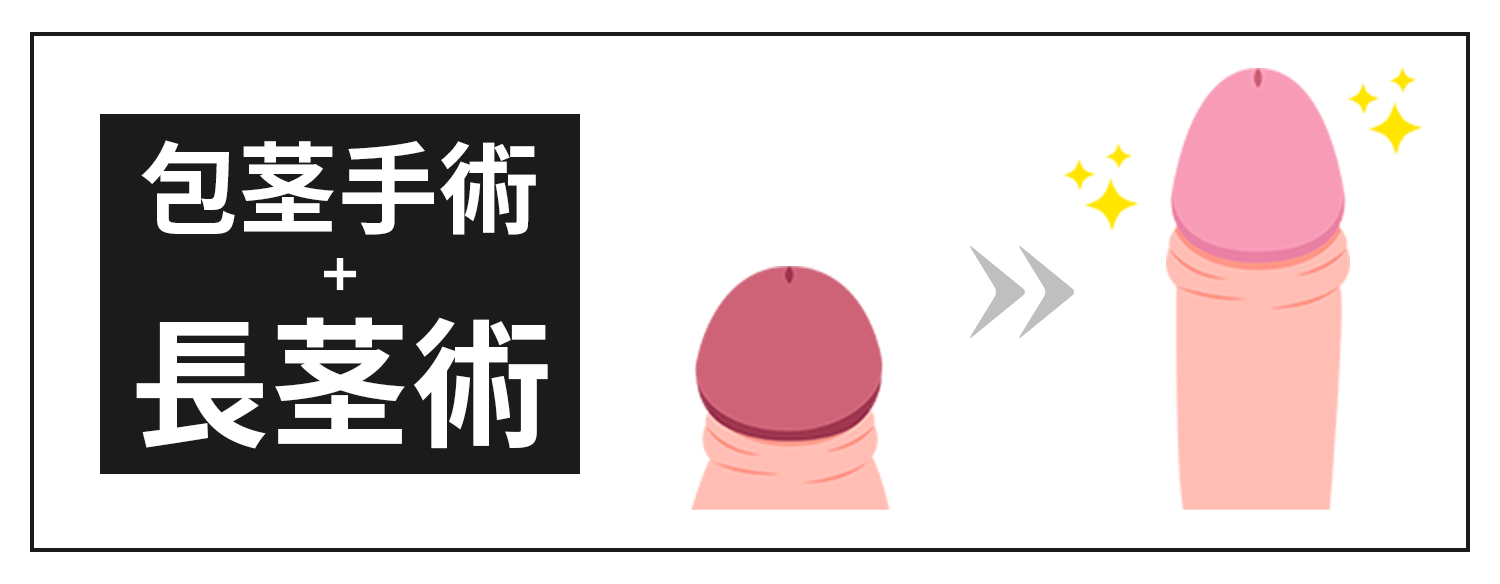 包茎手術+長茎手術
