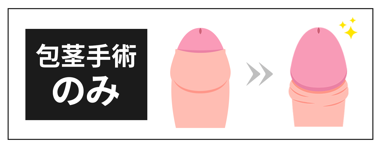 包茎手術のみ