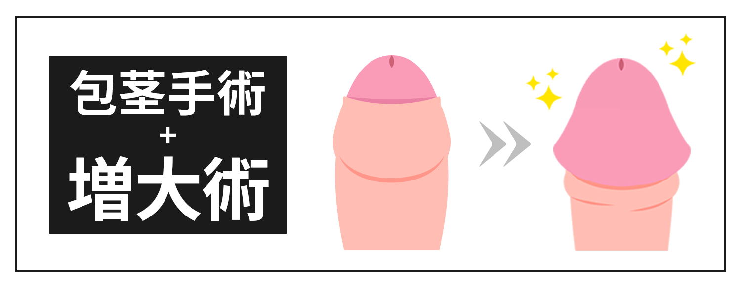 包茎手術+増大手術