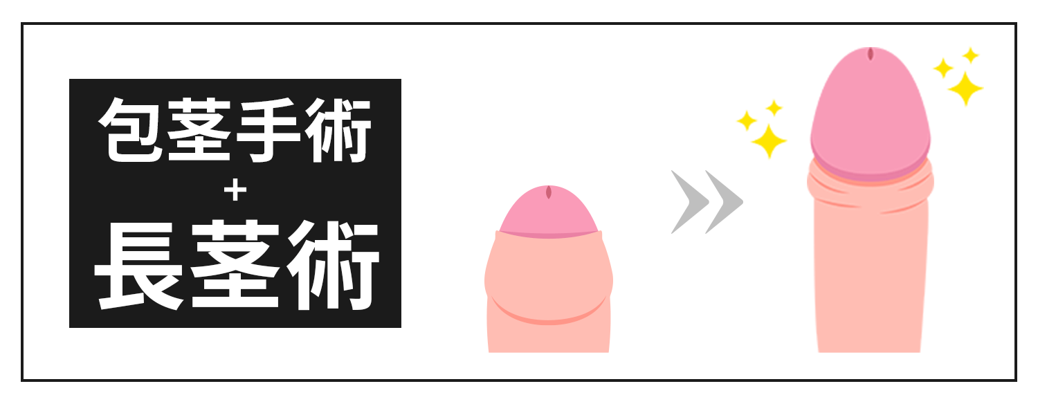 包茎手術+長茎手術