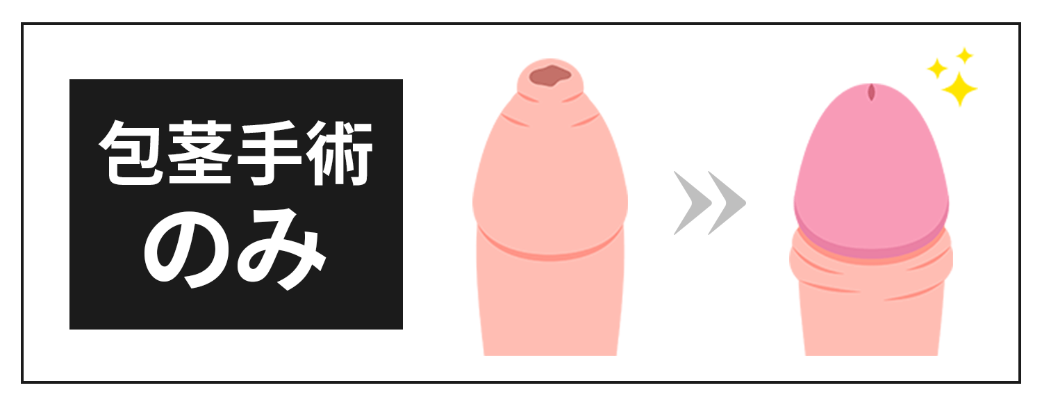 包茎手術のみ