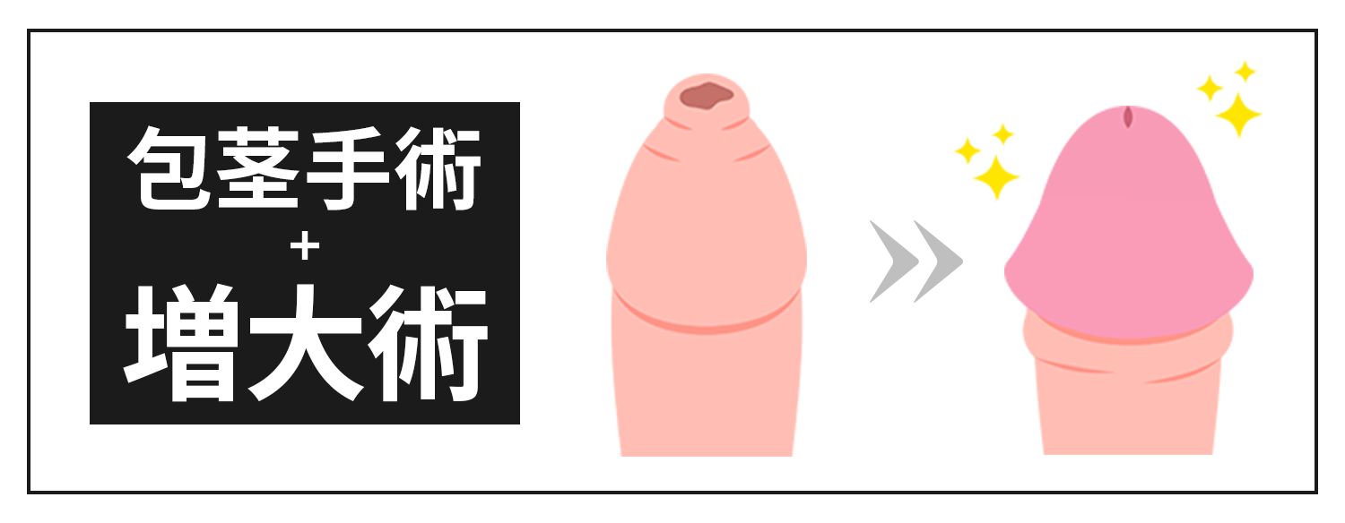 包茎手術+増大手術