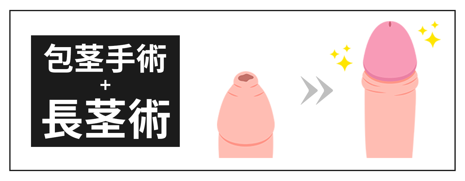 包茎手術+長茎手術