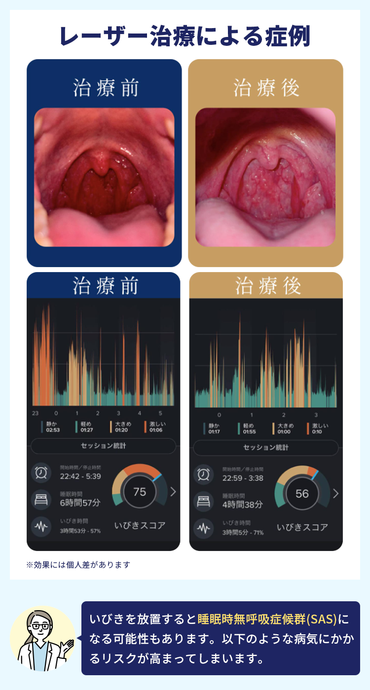 レーザー治療による症例