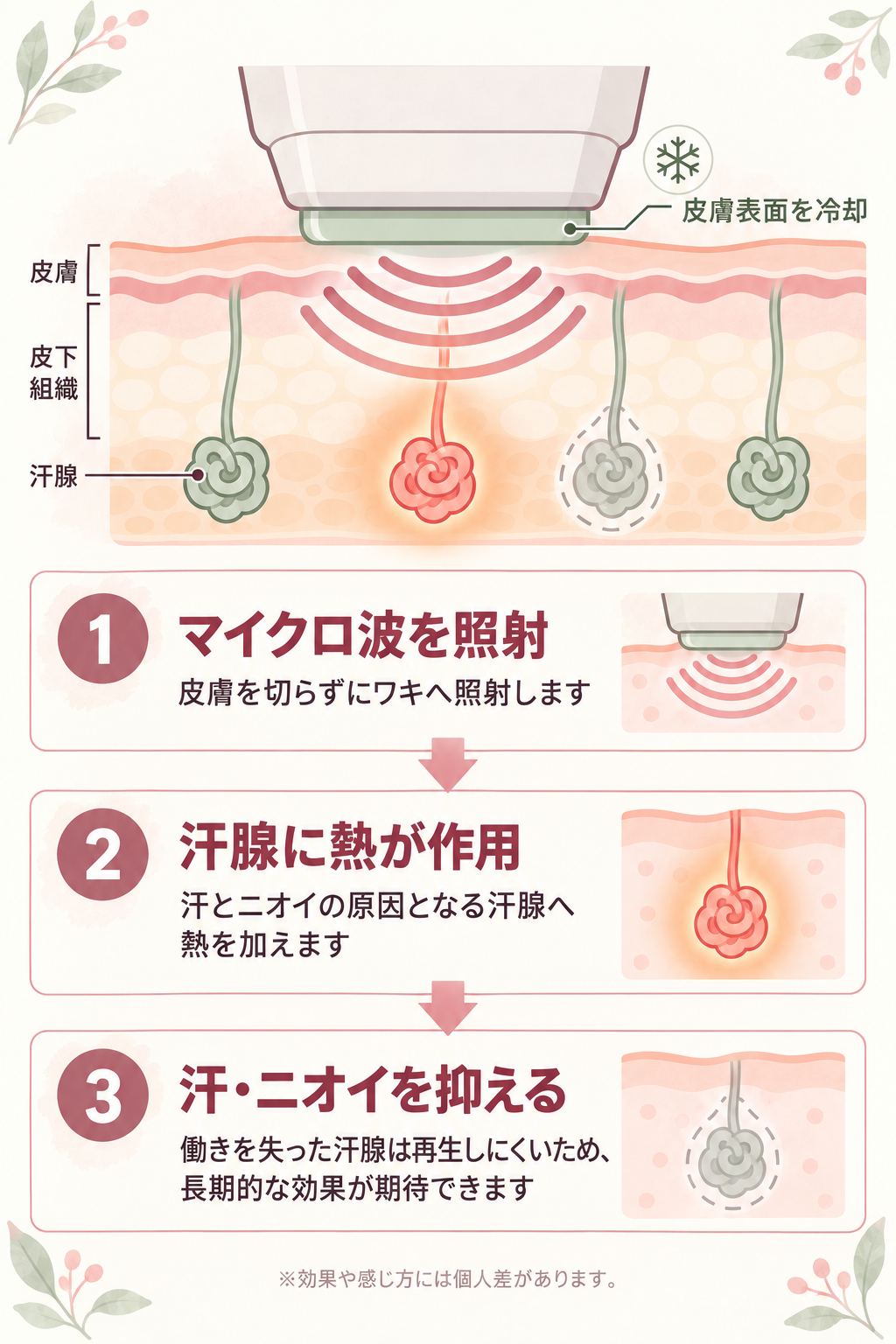 ミラドライの仕組み
